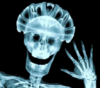 x-ray image of a person wearing a bicycle helmet